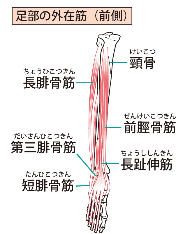 シンスプリントとは?