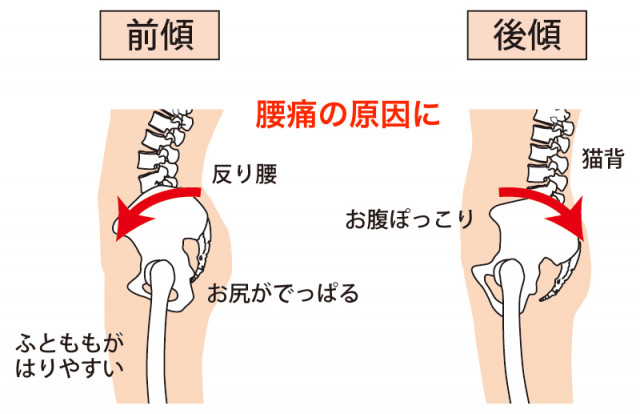 産後の腰痛の原因