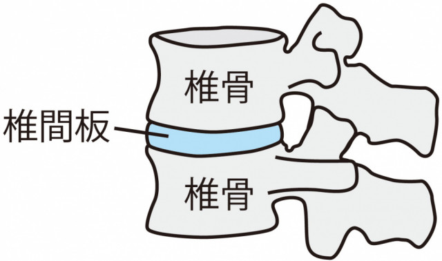 そもそも「頚椎症」とは?